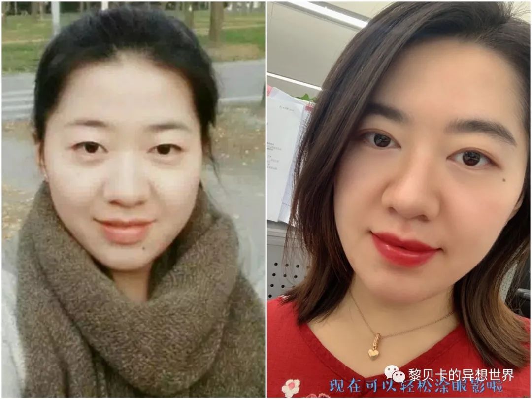 做完医美真的能换脸吗,做完医美需要注意什么