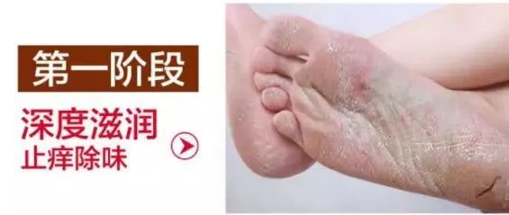 脚臭脱鞋多久可以去味,脱鞋臭脚怎么快速除臭
