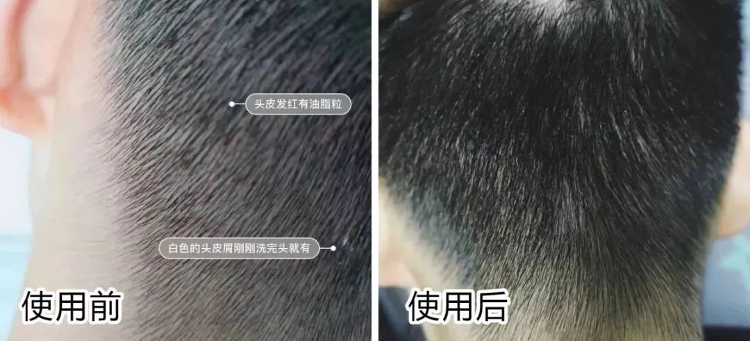 法国Lérane草本净螨贴，萃取天然植物，除螨更安心