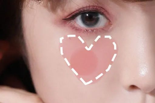 周雨彤祛痘神器,周雨彤的泪沟神器