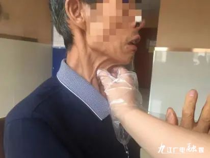 重回有声世界创造生命精彩——言语治疗科普