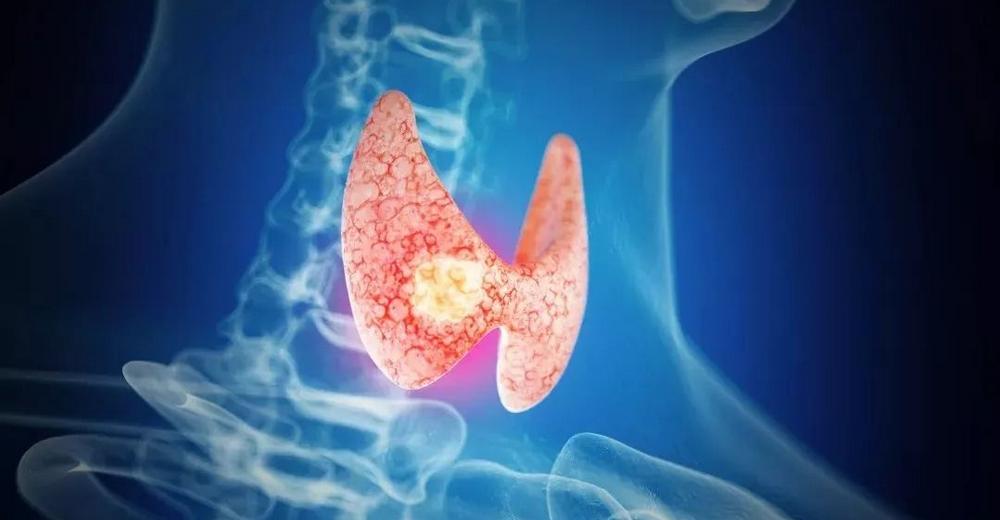 妊娠期亚临床甲状腺功能减退,妊娠期甲功异常