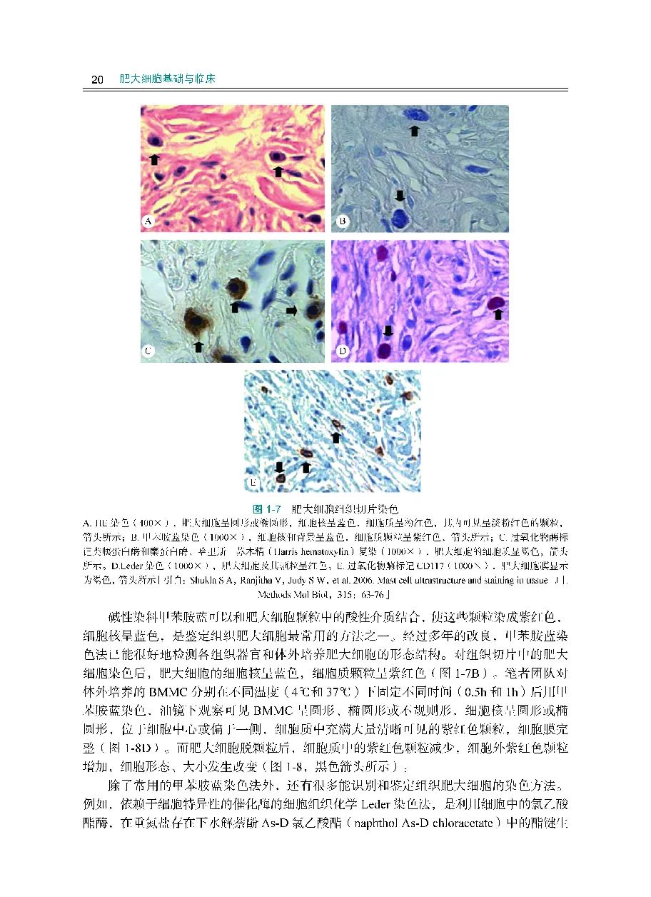 肥大细胞症,肥大细胞产生在哪