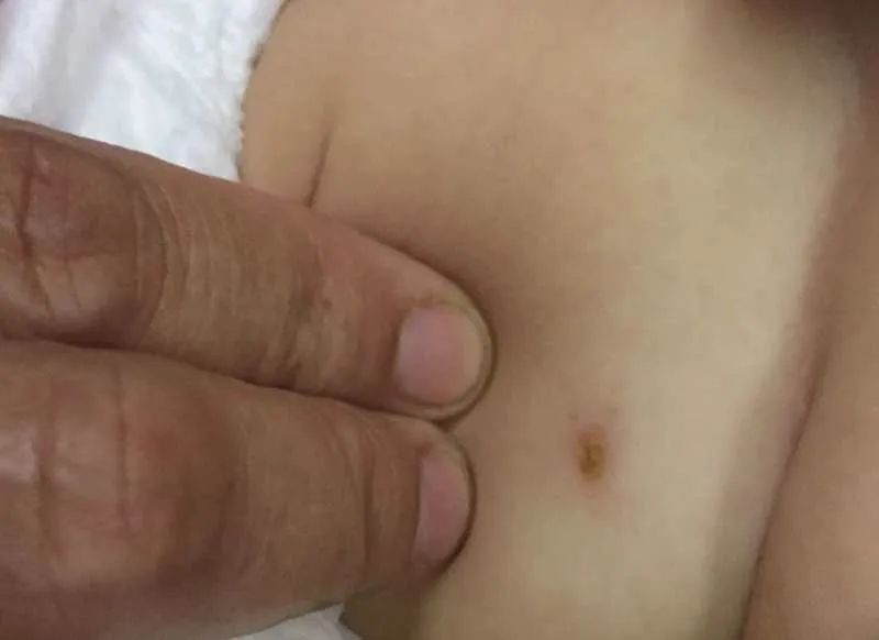 婴儿持续高烧多久要送医院,宝宝高烧持续六七个小时