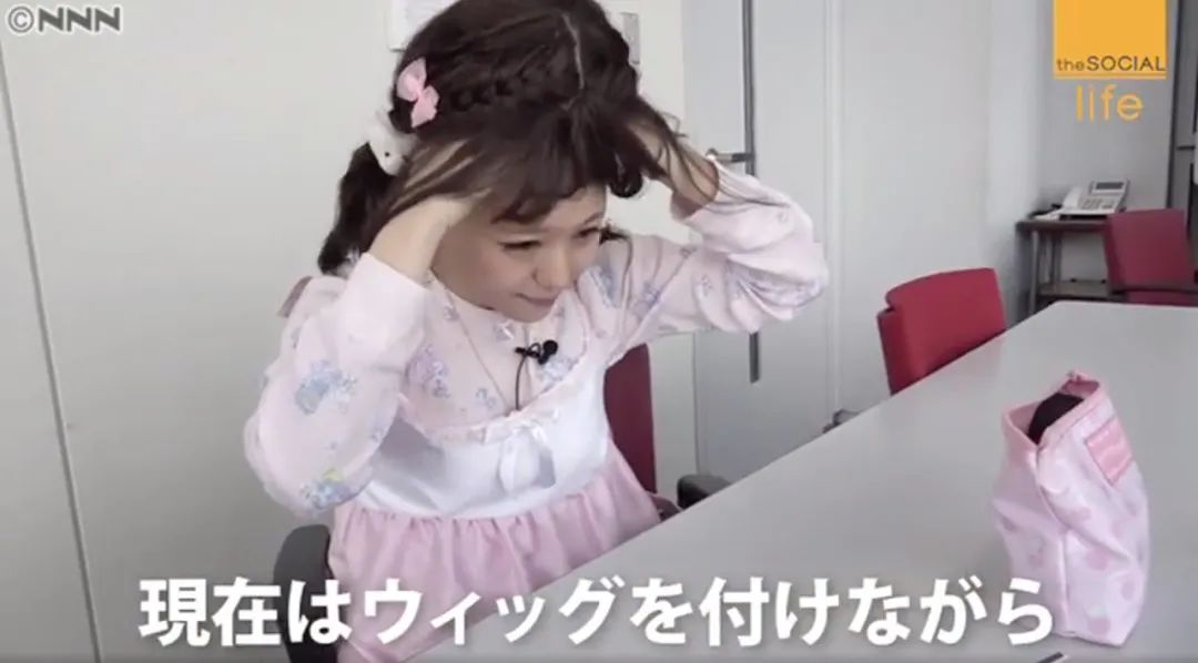 日本16岁美少女偶像歌手脱发到光头！“沦为”假发模特后的她，没有忘记自己甜美的笑容...