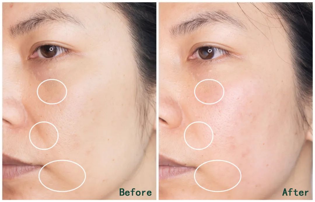 推广｜|下半年想买的第一个大件，我推荐它