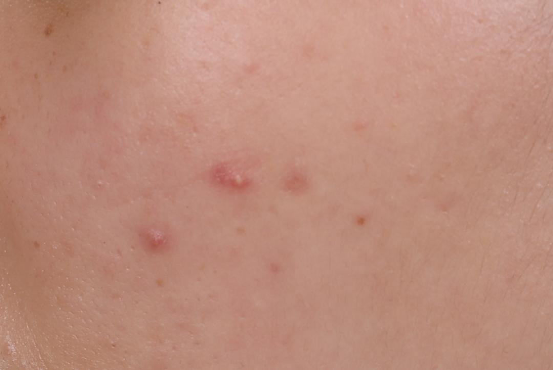 皮肤问题要去专门的皮肤医院吗,各种皮肤问题去哪个医院