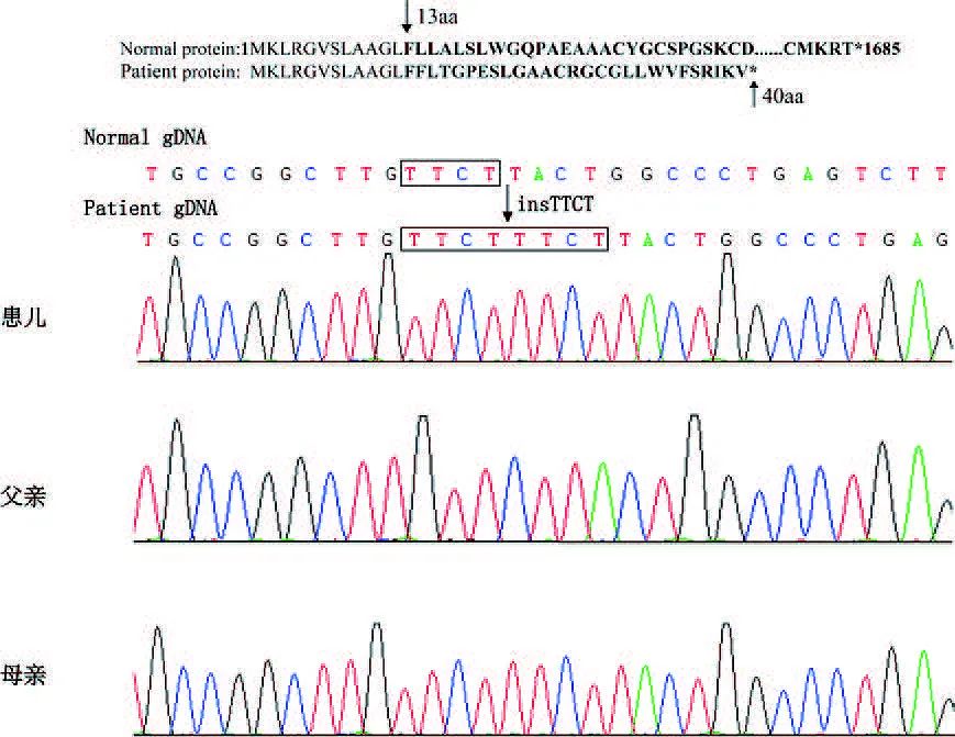 col4a5基因怎么检测,col4a5基因突变严重吗