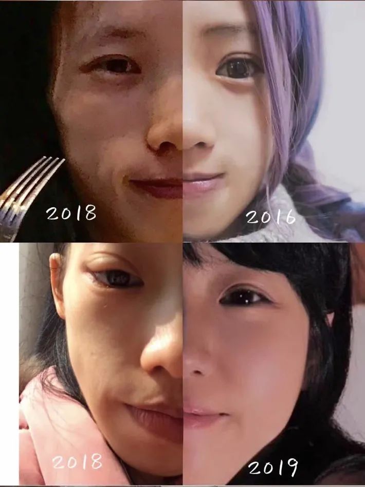 减肥21天icu,减肥到50斤进icu