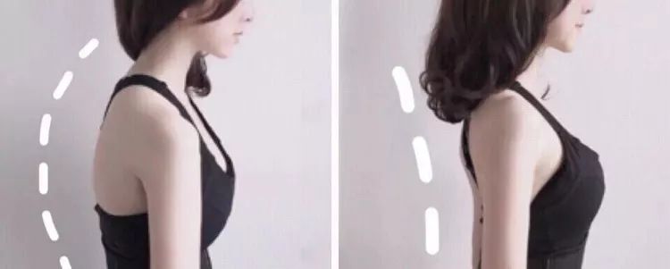 改善含胸驼背的最有效方法10分钟,改善含胸驼背的最有效方法完整版