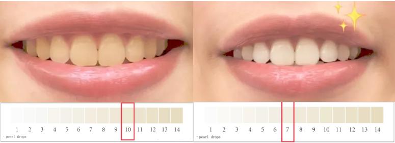 牙齿变黄你真的刷对了吗,牙齿黄了怎么办不用花钱去洗牙