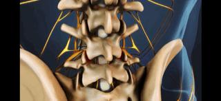 腰痛的真正原因是什么,腰痛要警惕五种原因