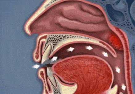 儿科专家小孩睡觉打呼噜,儿科专家小孩睡觉打呼噜在第几集