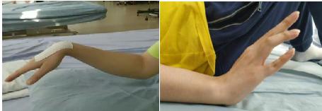 一觉醒来发现手残了,一觉醒来手残了怎么办