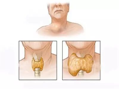 鏁欒偛鏁撮】鎴掓瘨,鏁欒偛鏁撮】绂佹瘨