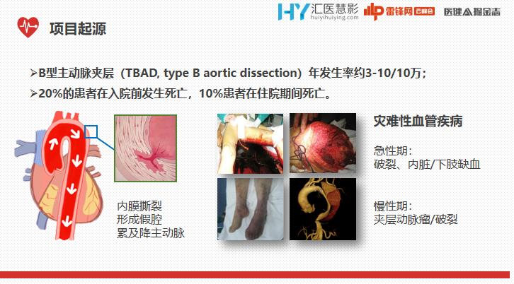 ai辅助医生心血管疾病诊断效率,ai技术治疗心血管疾病