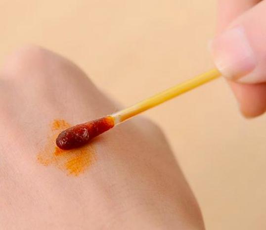 皮内注射的皮肤消毒剂,实验室常用于皮肤的消毒剂有哪些