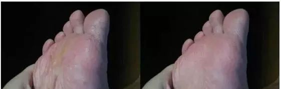 莉碧儿玻尿酸晶萃保湿面膜,莉碧儿水润保湿面膜怎么样