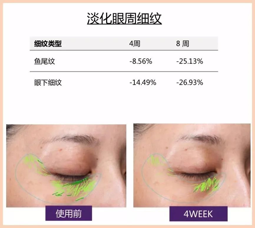 平价眼霜中的扛把子!欧莱雅紫熨斗抗皱、去细纹眼霜,卖到断货