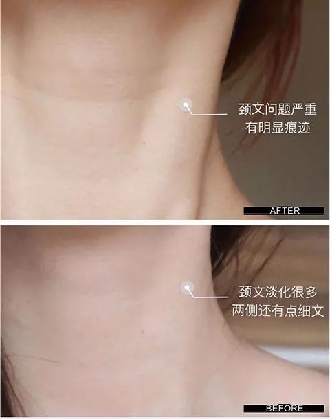 眼霜排行榜前十名欧莱雅紫熨斗,推荐眼霜欧莱雅紫熨斗