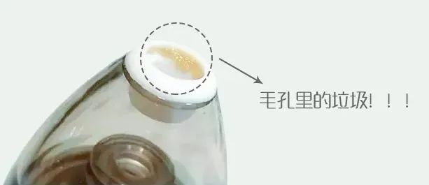 痘痘挤出的白米粒是什么,痘痘挤出来的白色乳浆是什么