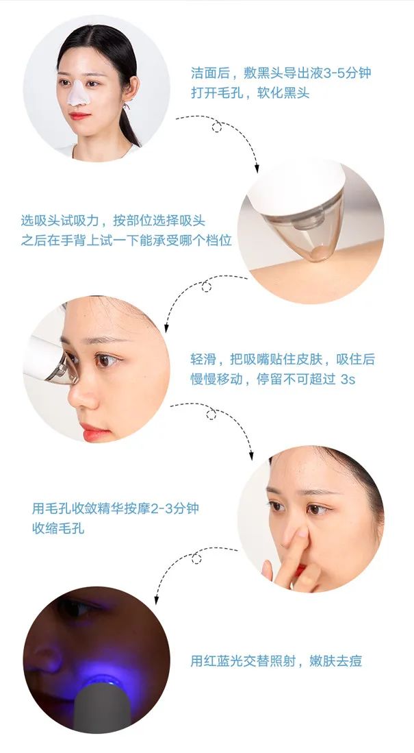 痘痘挤出的白米粒是什么,痘痘挤出来的白色乳浆是什么