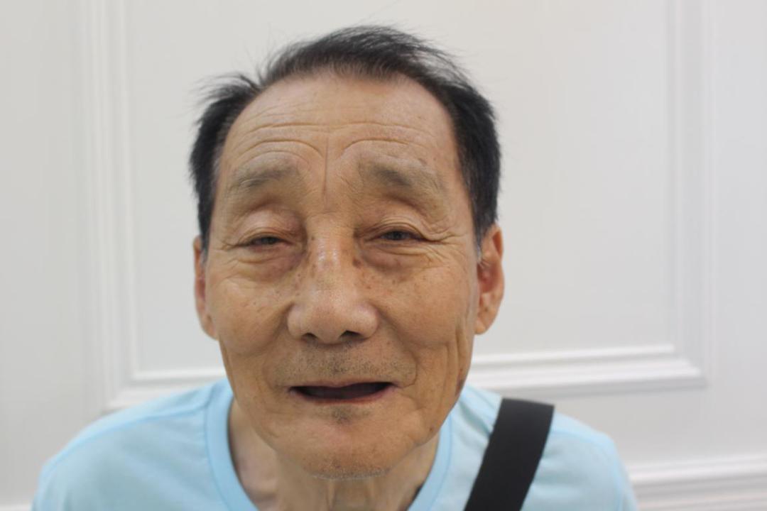 年轻牙齿掉光是什么因果,年轻人牙齿全部一次性掉光