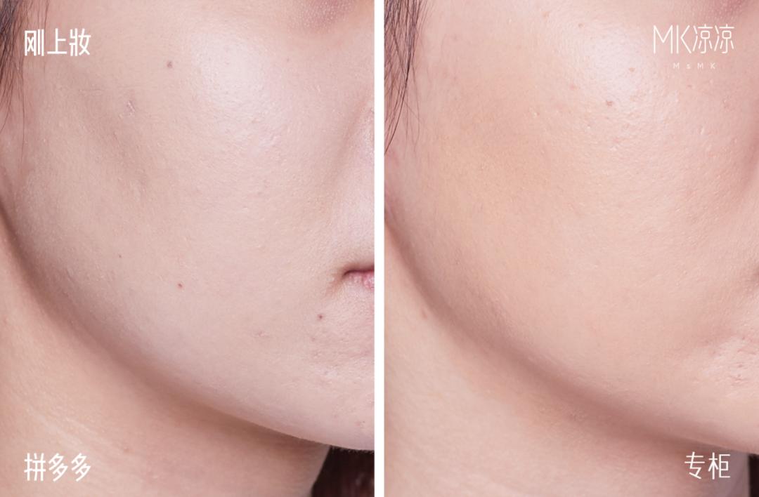 拼多多上的骨折骨裂膏有用吗,拼多多上的便宜药靠谱吗