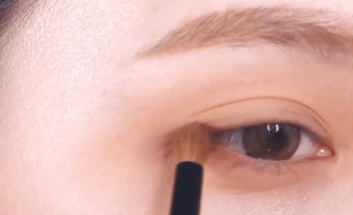 眼综合包含在眼综合吗,眼综合每个人都适合吗