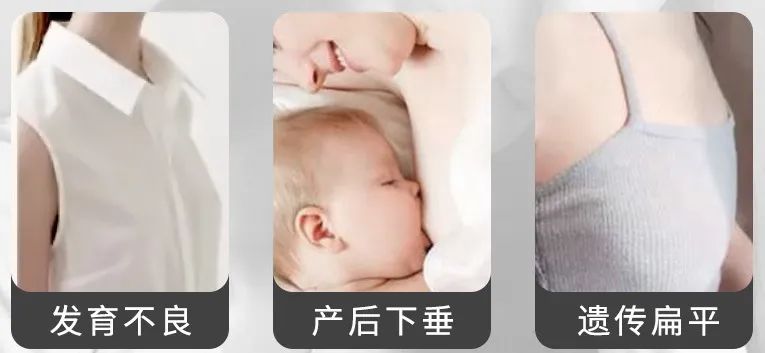 如何快速丰胸且不会反弹,不吃药怎么丰胸