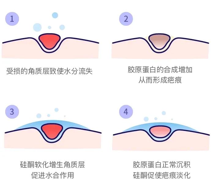 贴上就能消除疤痕是真的吗,脸上有疤如何淡化疤痕