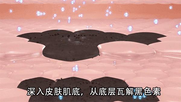 花了3万做激光，才彻底懂了：医生为什么劝你别去斑