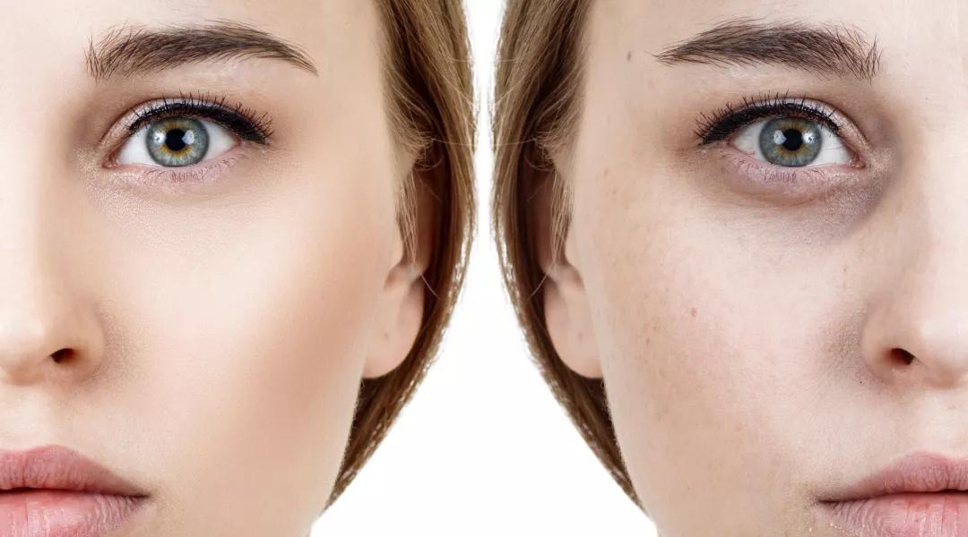 最好用的去眼纹黑眼圈的眼霜,淡化眼纹和黑眼圈的眼霜推荐