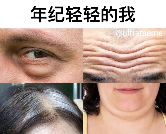 汪苏泷脸摔肿,汪苏泷的脸摔肿了