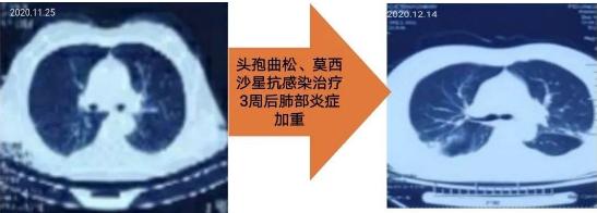 咸阳市第一人民医院风湿血液科,风湿骨病妙手医生