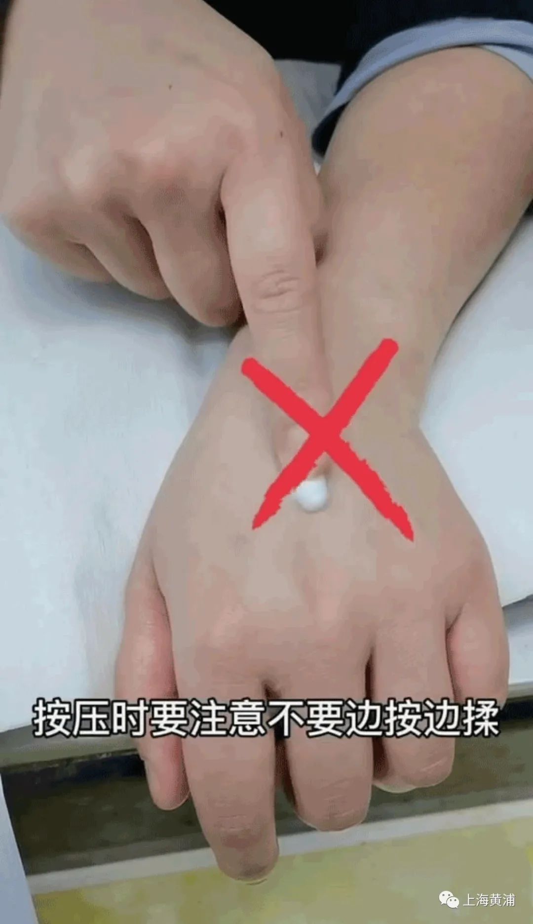 手上输液后黑青怎么办,手上输液有青块怎么快速消除