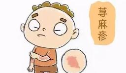又痒又痛的红色疹子,又长湿疹又长荨麻疹怎么办