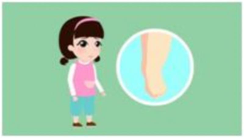 儿童双眼水肿什么原因,幼儿肾病眼睑浮肿眼睛流泪