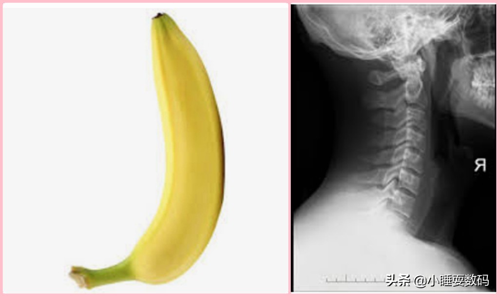 有颈椎病适合用什么类型的枕头,最好的保护颈椎的专用枕头推荐