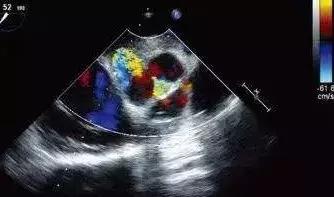 我明明开的是彩超,图像怎么是黑白的?