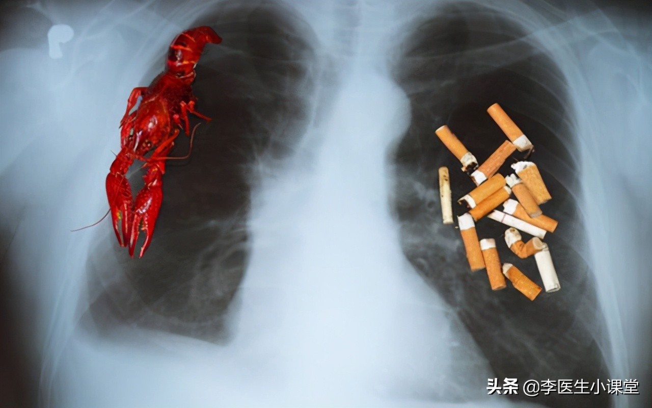 肺癌术后复发或转移，会有征兆吗？再复发还能怎么治？