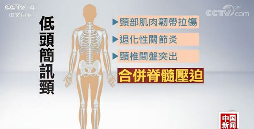 低头看手机时脖子承受什么,低头看手机的后果