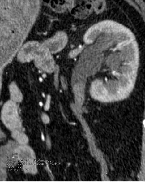 造影检查会让人痛苦吗:带你了解一下各种造影检查的操作过程