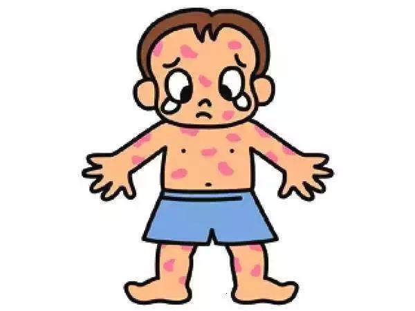 蛇胆膏治疗带状疱疹,蛇胆疮疱疹用什么药最好