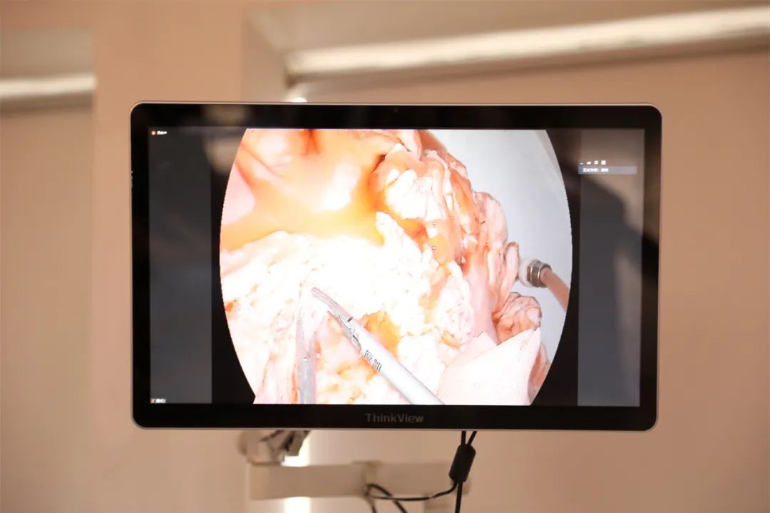 医师节超声科微视频,医师节彩超室创意视频