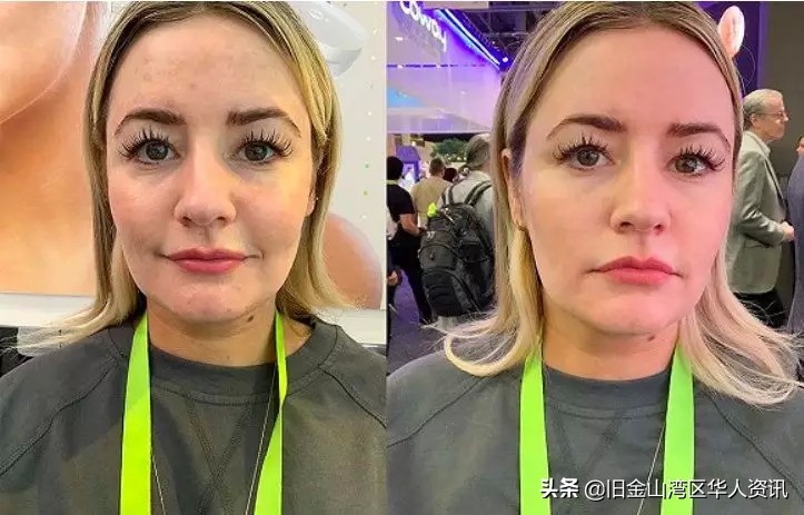 鑴搁儴澶勭悊ps,鐟曠柕鑴镐慨澶峱s