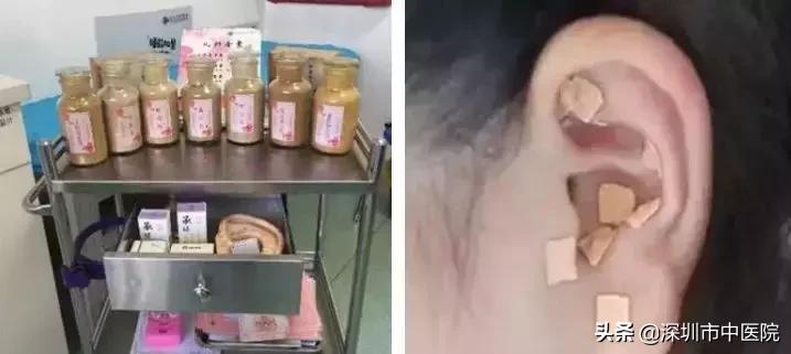 儿童多动抽动名医,中医如何治疗抽动多动