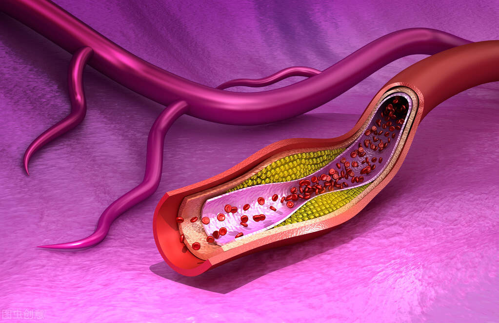 治疗高脂血症吃哪种中药好,高脂血症用什么降脂药