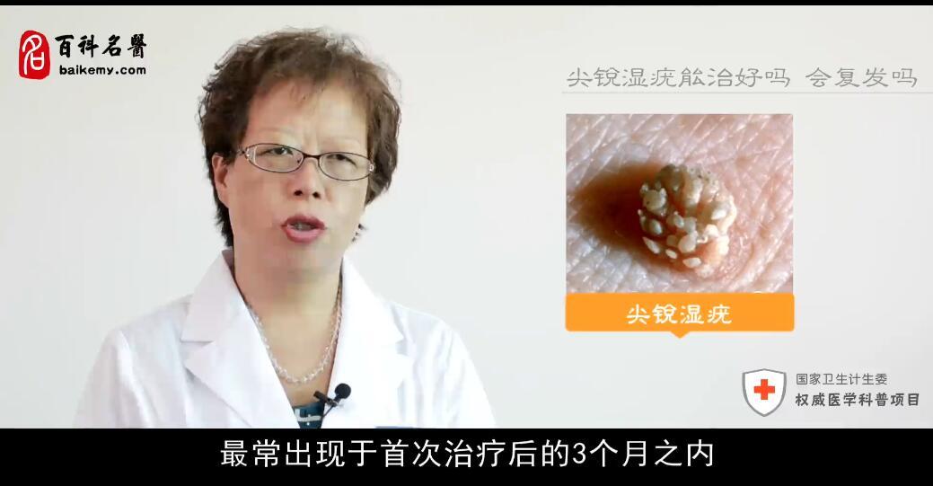 尖锐湿疣是否容易复发？