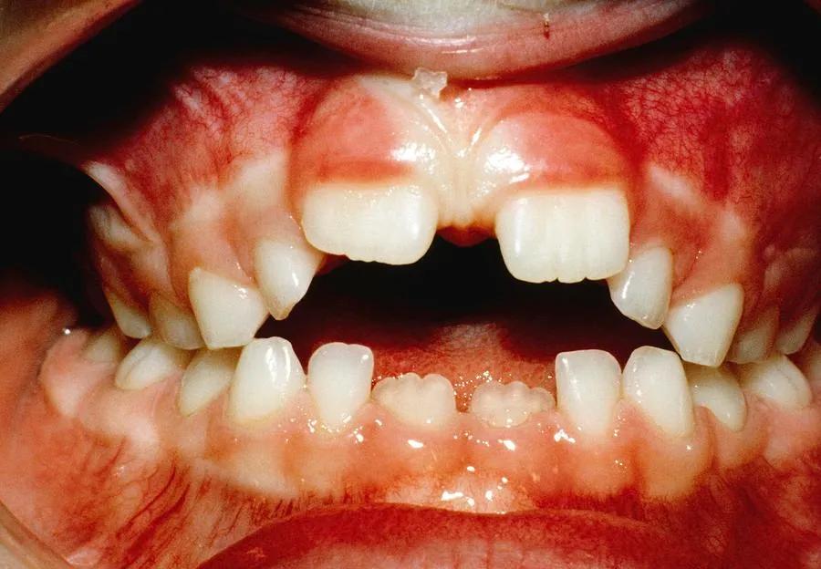 3岁小孩总吃手怎么戒掉,孩子四岁了还老是吃手怎么教育